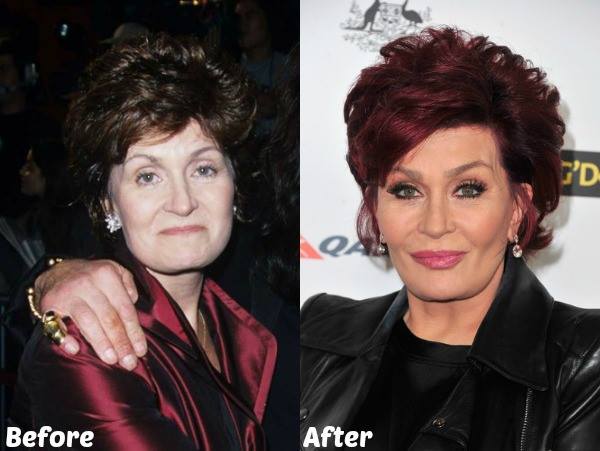 cliomakeup-riduzione-seno-14-sharon-osbourne