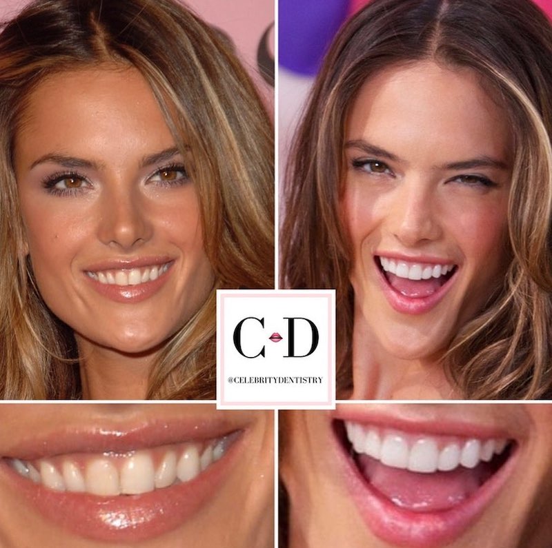 cliomakeup-denti-star-teamclio-4