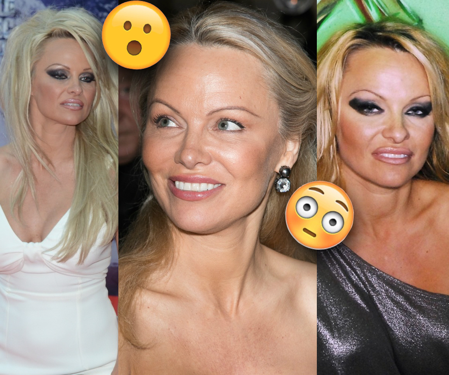 ClioMakeUp-star-tornate-naturale-makeunder-eccessive-glamour-chic-shock-irriconoscibile-pamela-anderson-prima-e-dopo.001