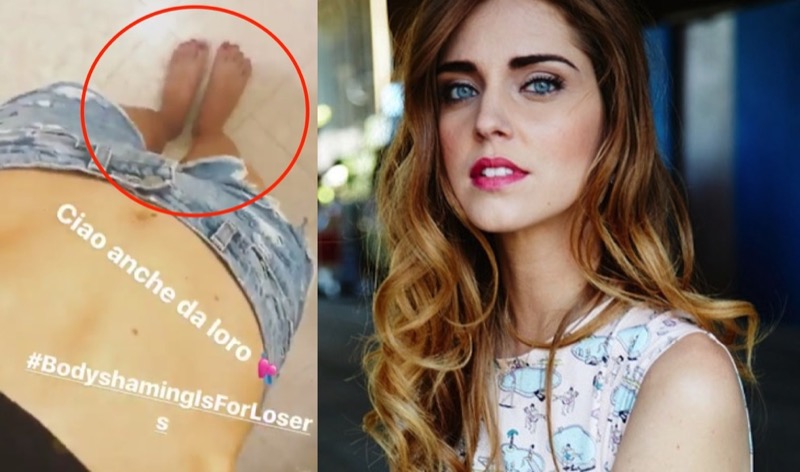 cliomakeup-piedi-brutti-vip-2-chiara-ferragni