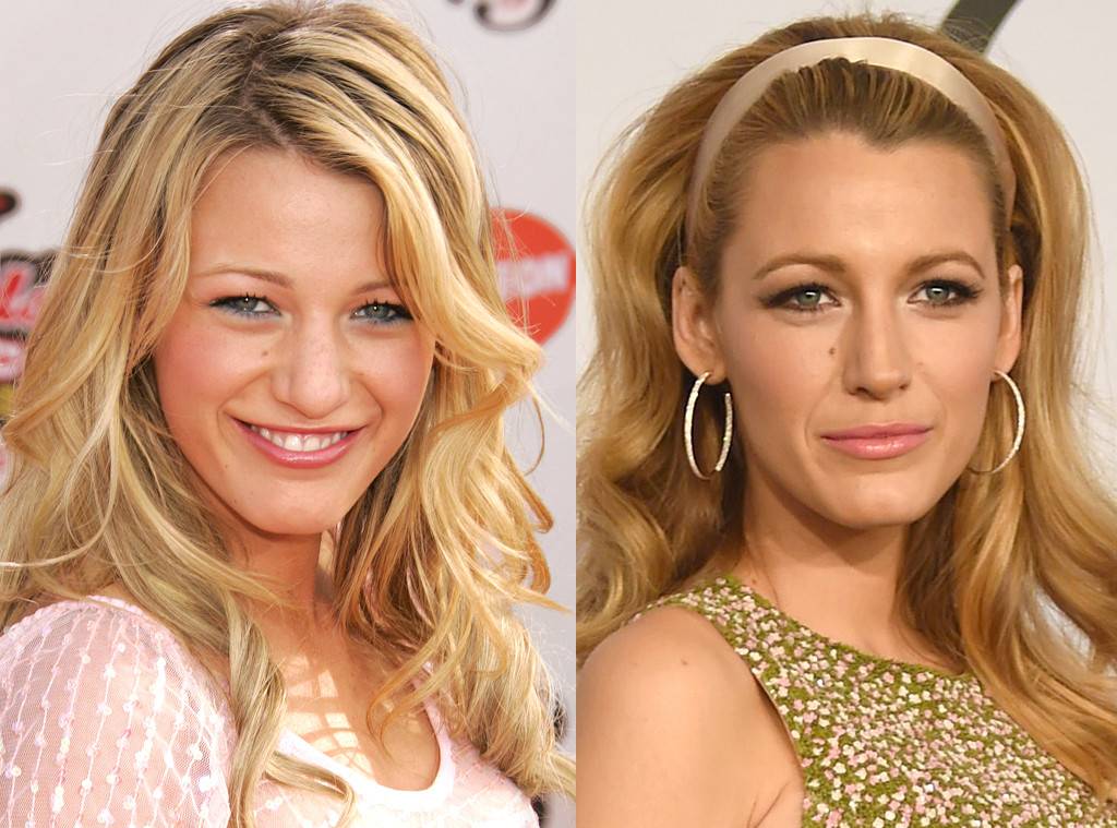 cliomakeup-dismorfia-da-snapchat-7-blake-lively