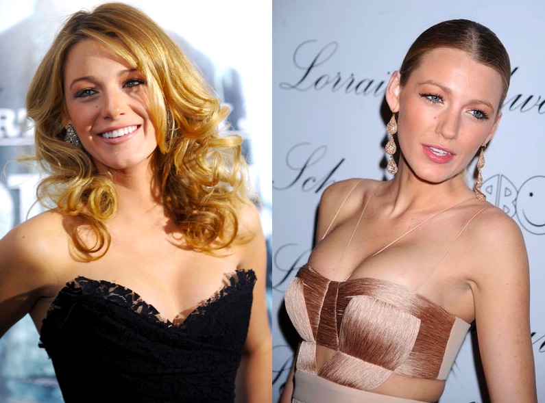 cliomakeup-attrici-seno.rifatto-14-blake-lively-prima-dopo