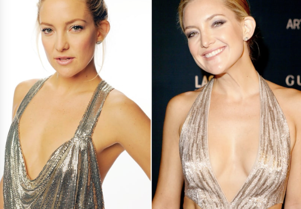 cliomakeup-attrici-seno.rifatto-3-kate-hudson