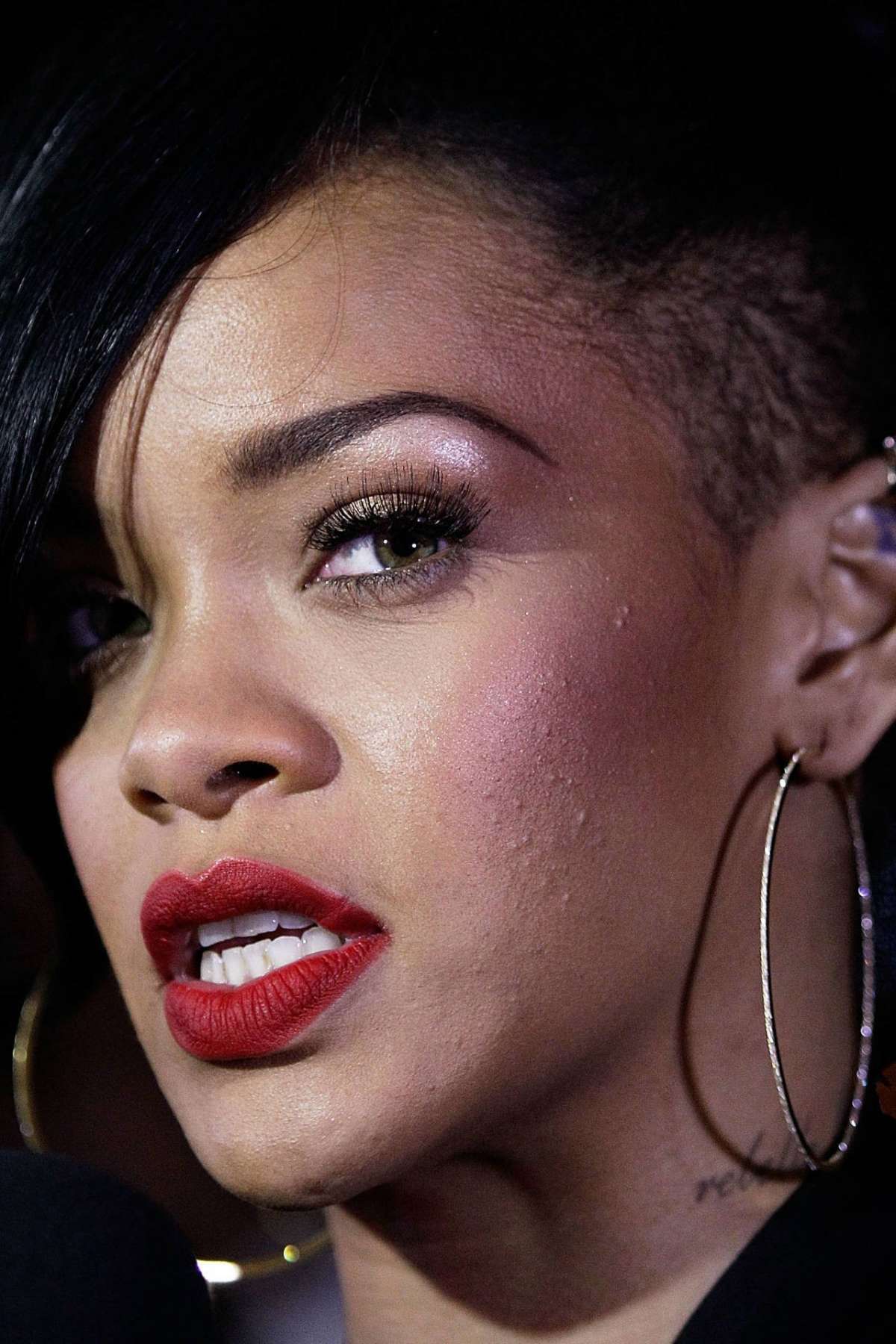 cliomakeup-skincare-primavera-7-rihanna-acne