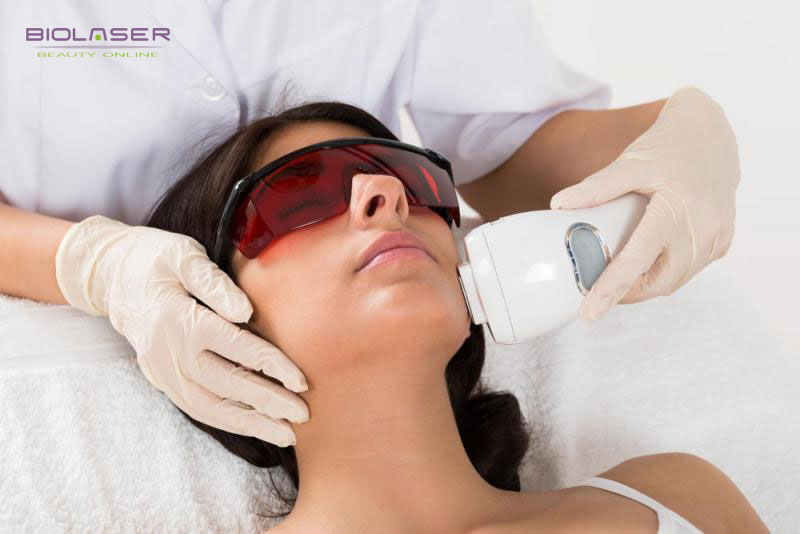 ClioMakeUp-ceretta-viso-15-epilazione-laser.jpg