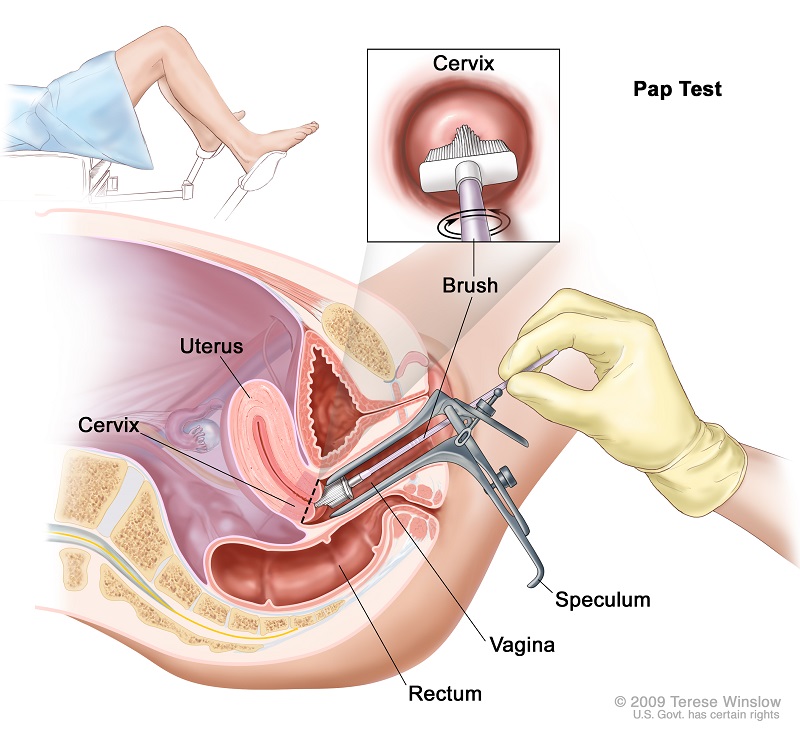 cliomakeup-pap-test-3.jpg