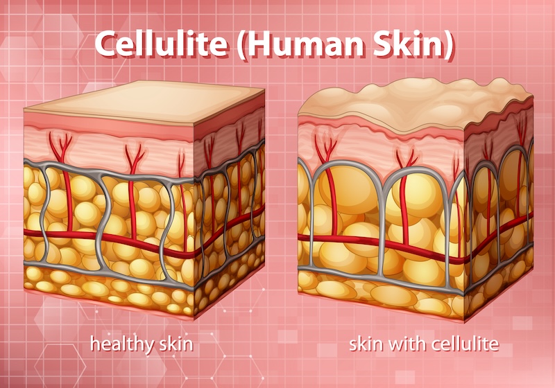 cliomakeup-integratori-cellulite-1