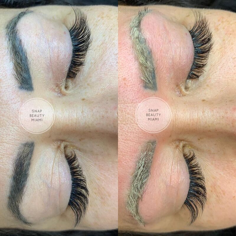 cliomakeup-microblading-sbagliato-laser