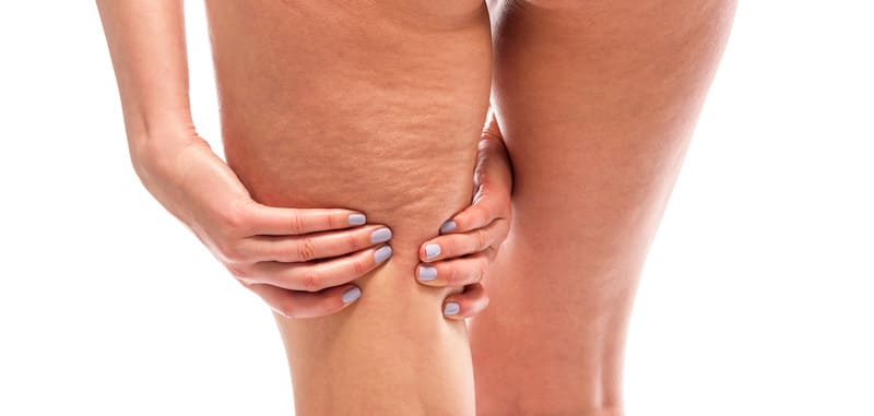 cliomakeup-problemi-pelle-gravidanza-cellulite